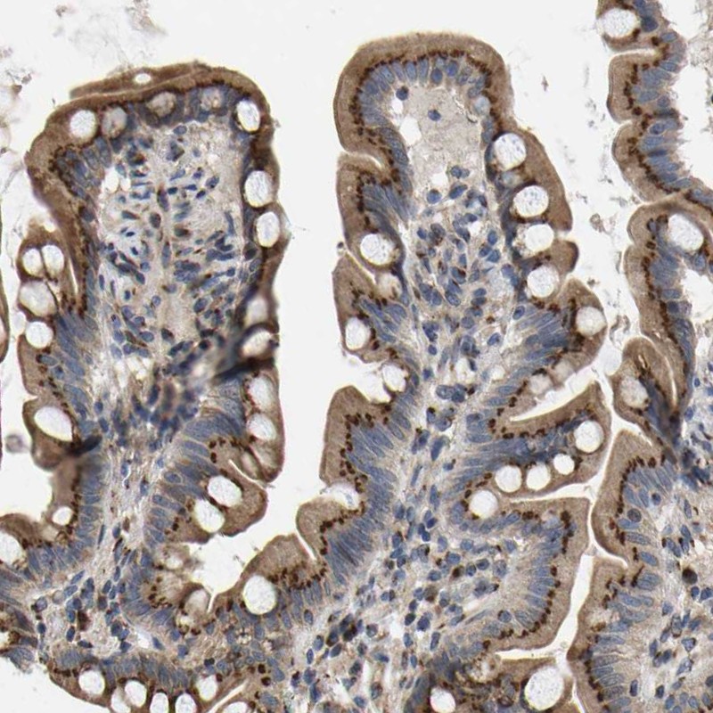 Atlas Antibodies Anti-YIPF4 Antibody