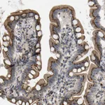 Atlas Antibodies Anti-YIPF4 Antibody