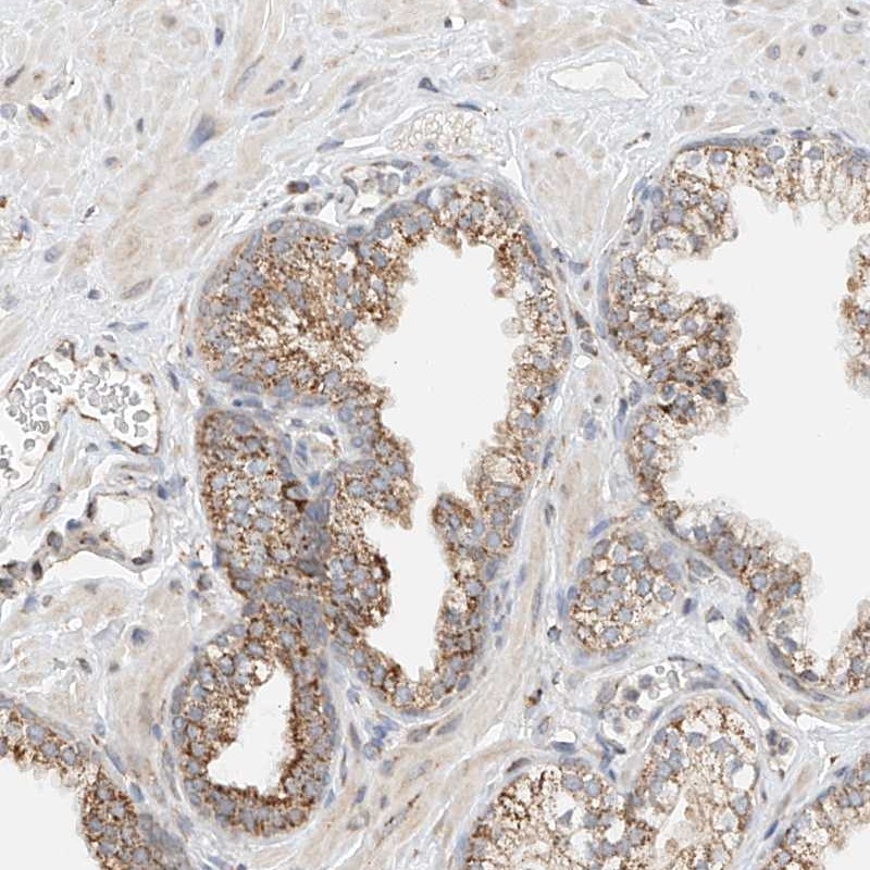 Atlas Antibodies Anti-YIPF7 Antibody