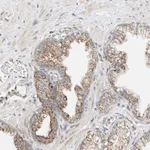 Atlas Antibodies Anti-YIPF7 Antibody