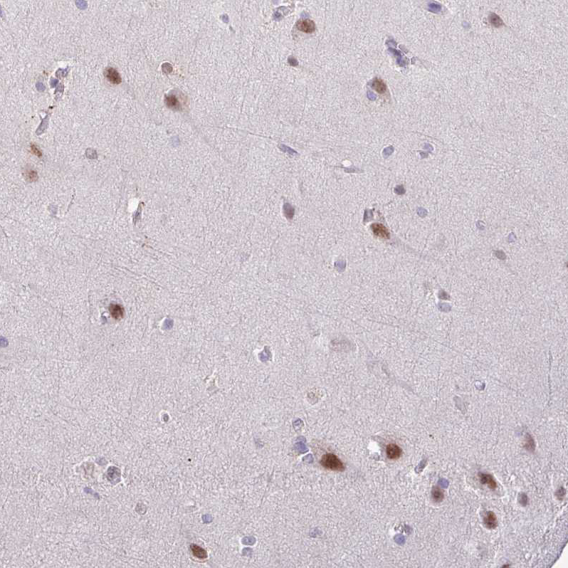 Atlas Antibodies Anti-YLPM1 Antibody