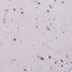 Atlas Antibodies Anti-YLPM1 Antibody