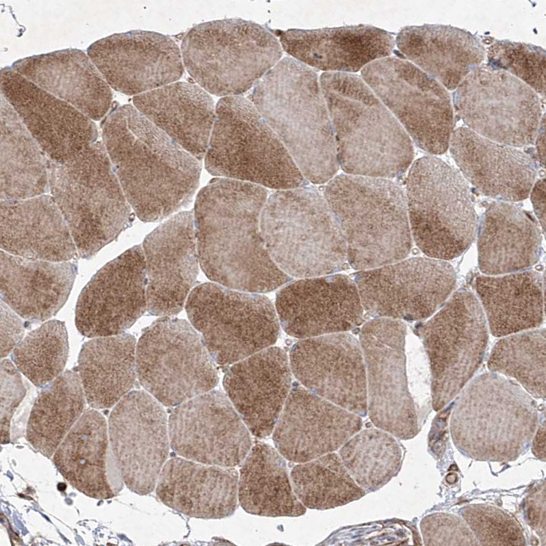 Atlas Antibodies Anti-YKT6 Antibody