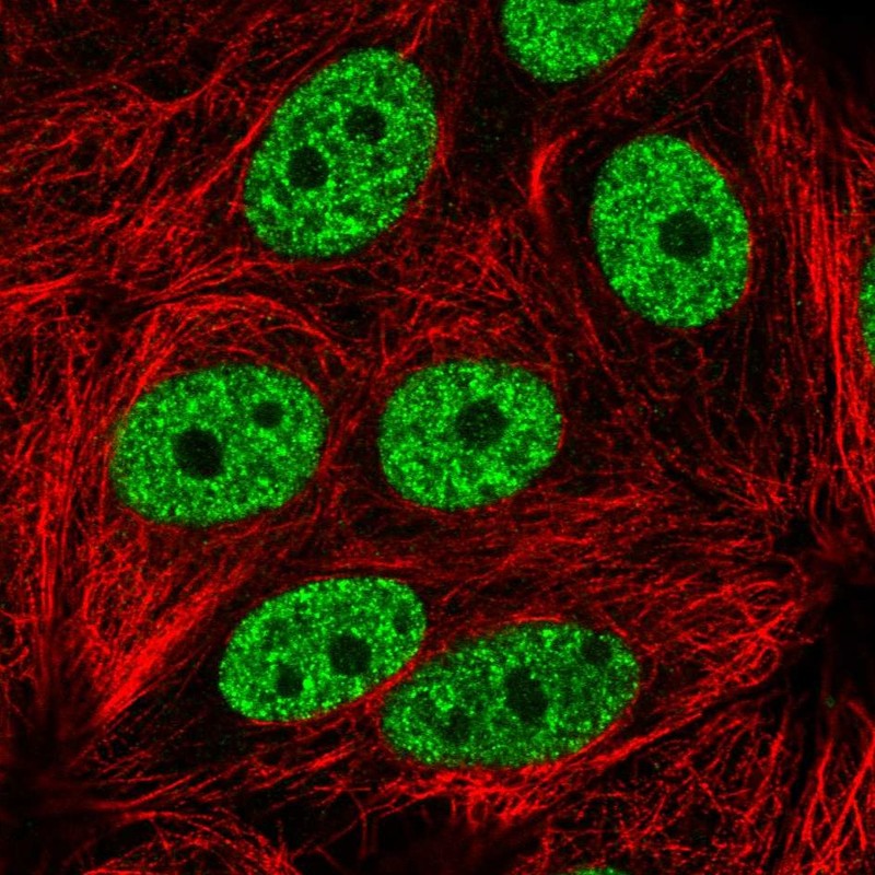 Atlas Antibodies Anti-YLPM1 Antibody