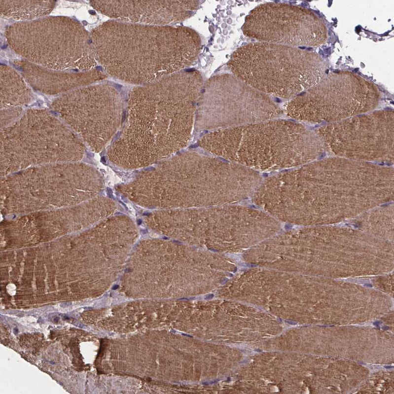 Atlas Antibodies Anti-YME1L1 Antibody