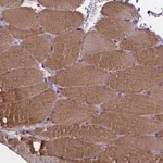 Atlas Antibodies Anti-YME1L1 Antibody