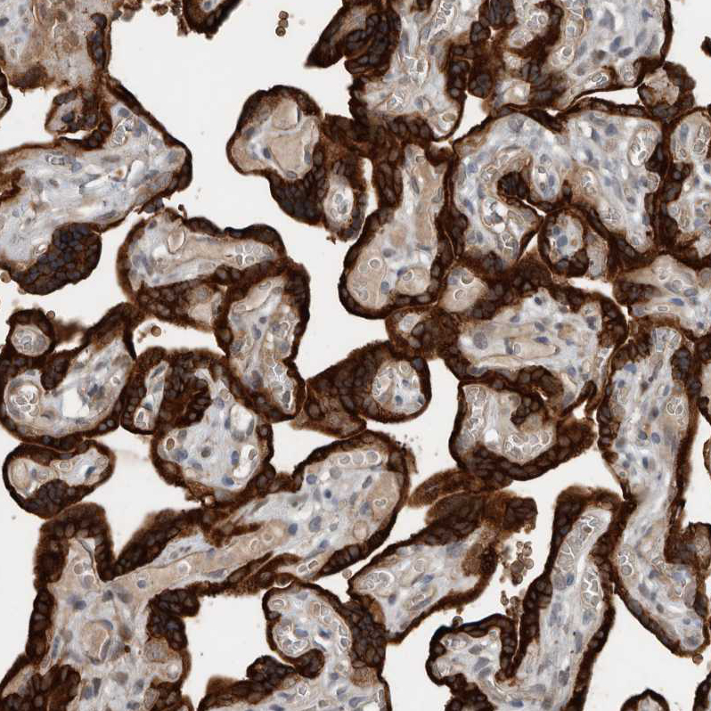 Atlas Antibodies Anti-YOD1 Antibody