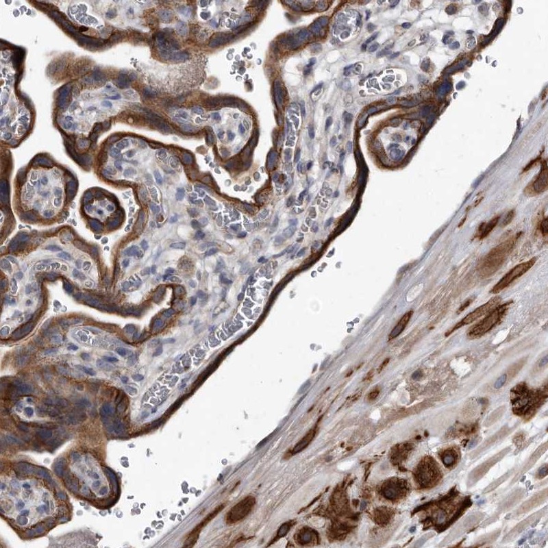 Atlas Antibodies Anti-YPEL3 Antibody