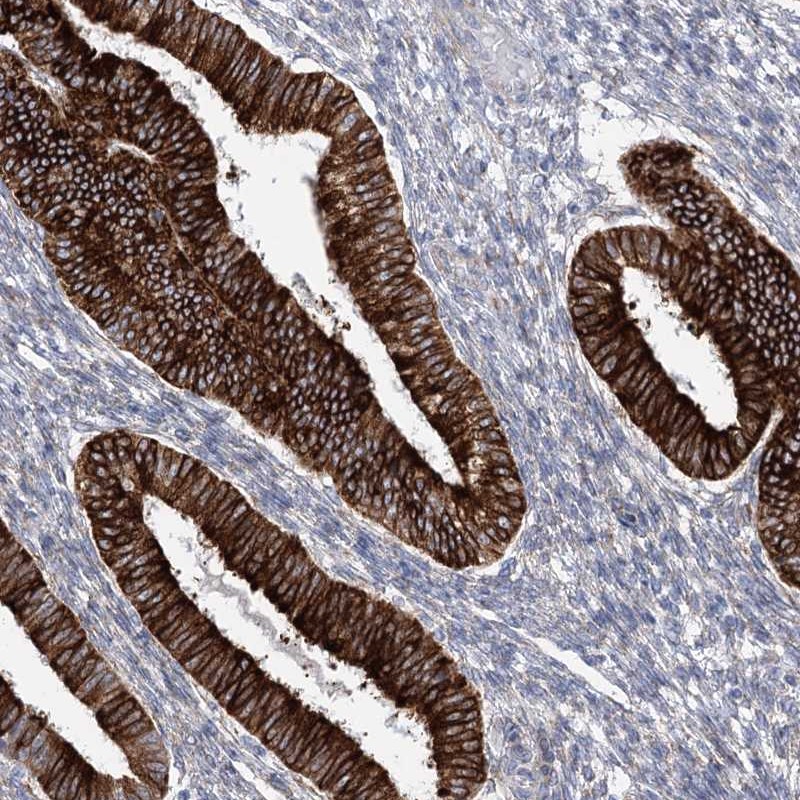 Atlas Antibodies Anti-YTHDC2 Antibody