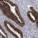 Atlas Antibodies Anti-YTHDC2 Antibody