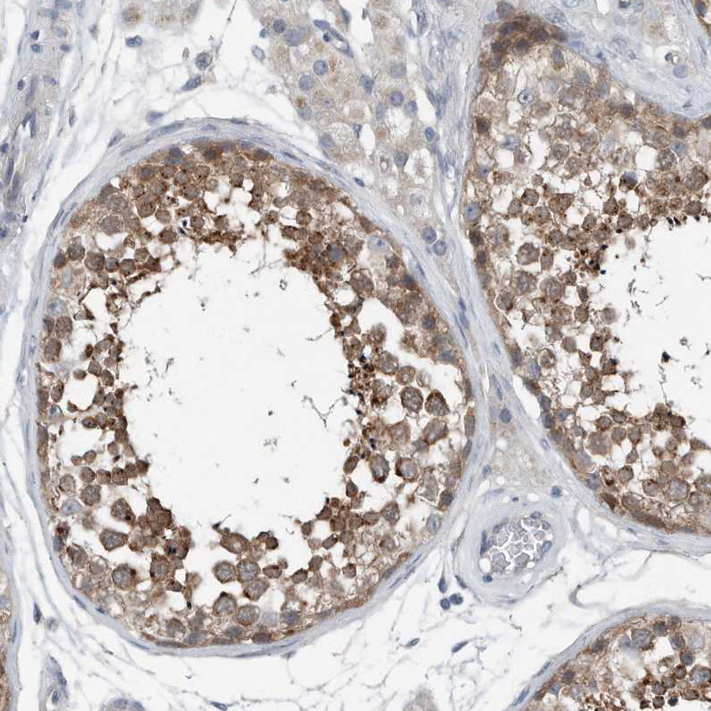 Atlas Antibodies Anti-YRDC Antibody