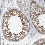Atlas Antibodies Anti-YRDC Antibody