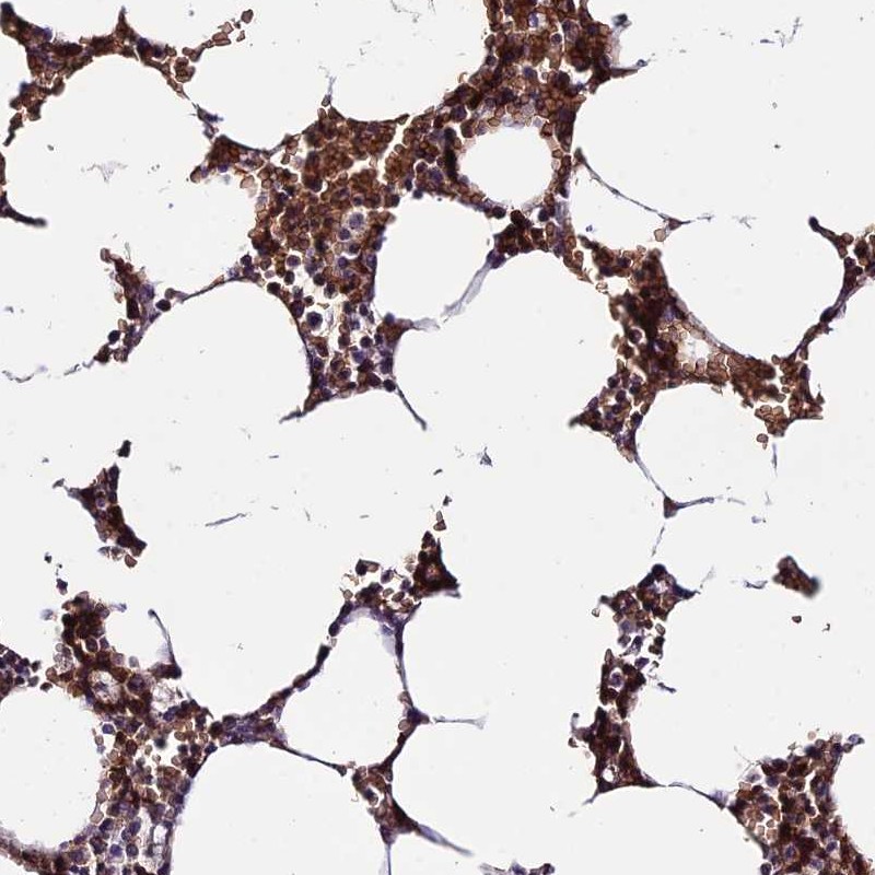 Atlas Antibodies Anti-YPEL5 Antibody