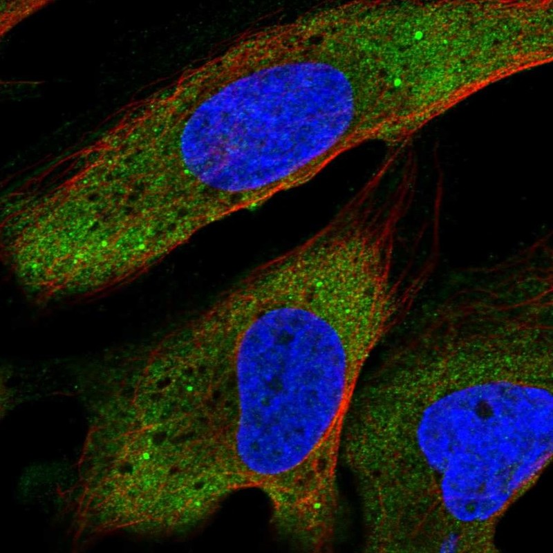 Atlas Antibodies Anti-YTHDF2 Antibody