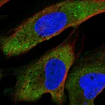 Atlas Antibodies Anti-YTHDF2 Antibody