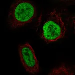 Atlas Antibodies Anti-YTHDC2 Antibody