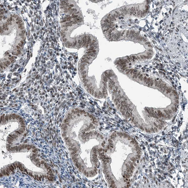 Atlas Antibodies Anti-YTHDC1 Antibody