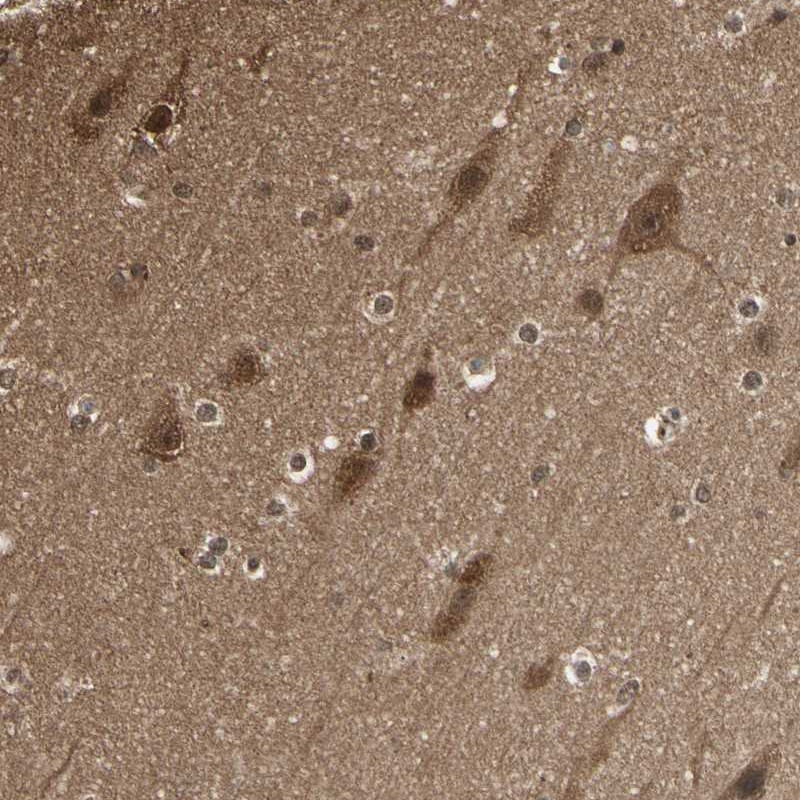 Atlas Antibodies Anti-YWHAB Antibody
