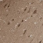 Atlas Antibodies Anti-YWHAB Antibody