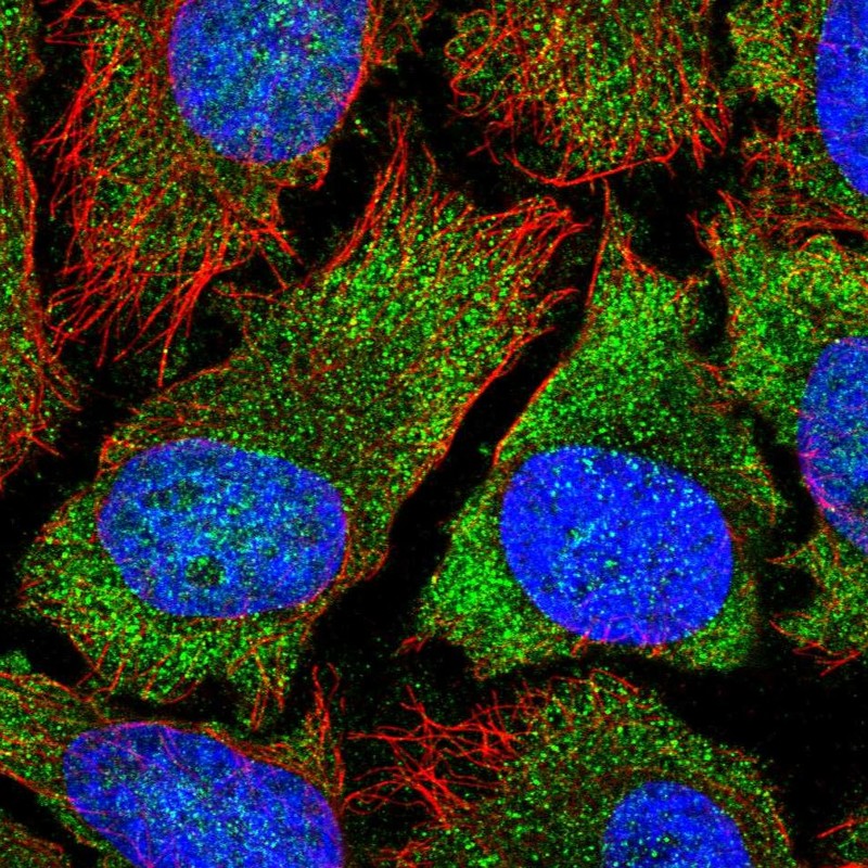 Atlas Antibodies Anti-YTHDF2 Antibody