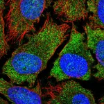 Atlas Antibodies Anti-YTHDF2 Antibody