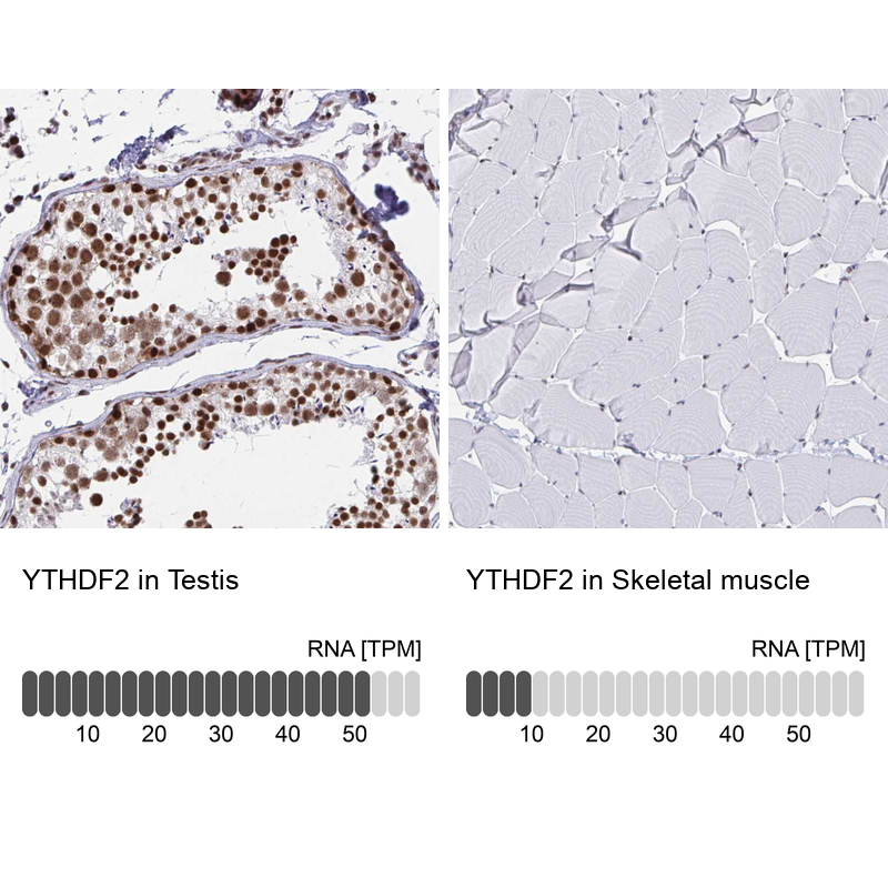 Atlas Antibodies Anti-YTHDF2 Antibody