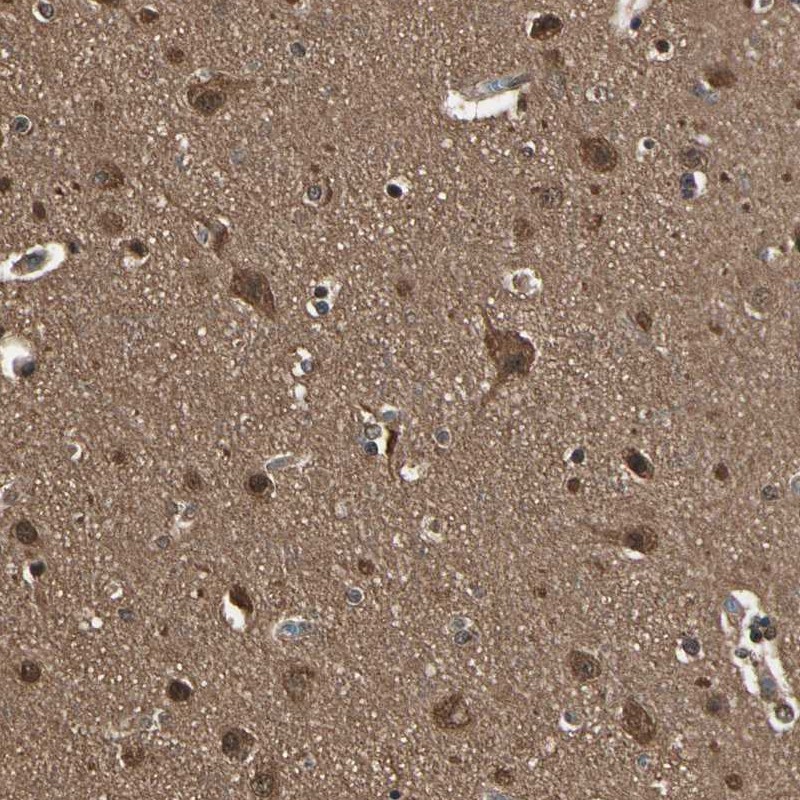 Atlas Antibodies Anti-YWHAE Antibody