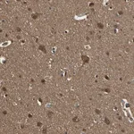 Atlas Antibodies Anti-YWHAE Antibody