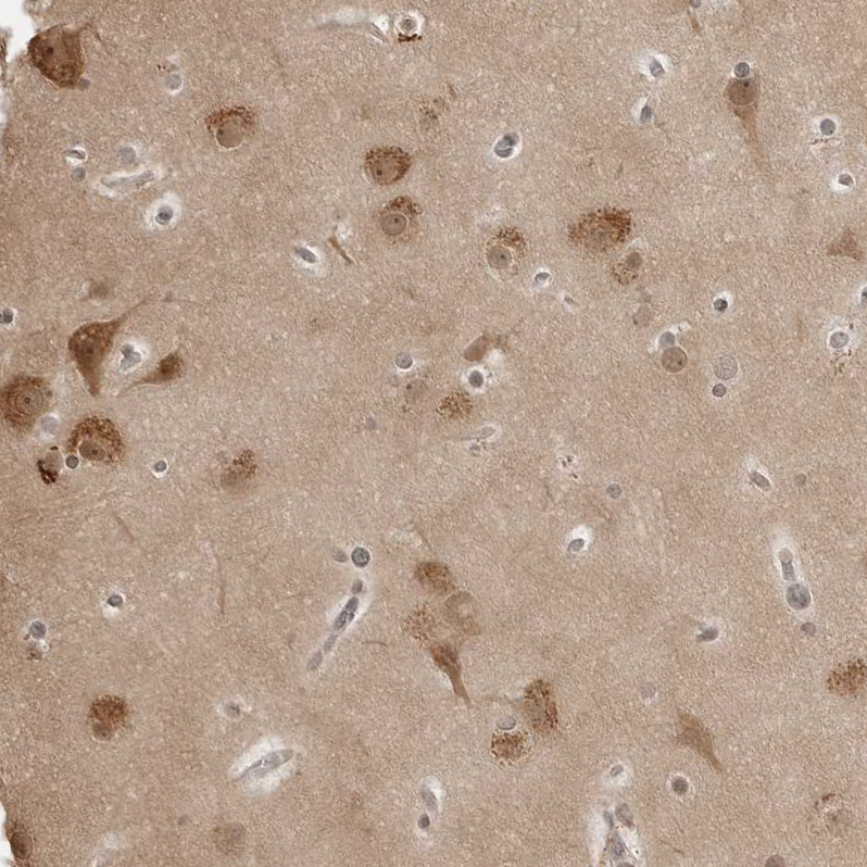 Atlas Antibodies Anti-YWHAG Antibody