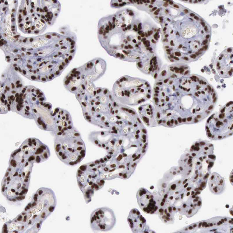 Atlas Antibodies Anti-YY1 Antibody