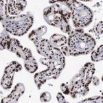 Atlas Antibodies Anti-YY1 Antibody