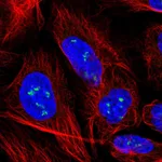 Atlas Antibodies Anti-YY1AP1 Antibody