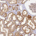 Atlas Antibodies Anti-YY1AP1 Antibody
