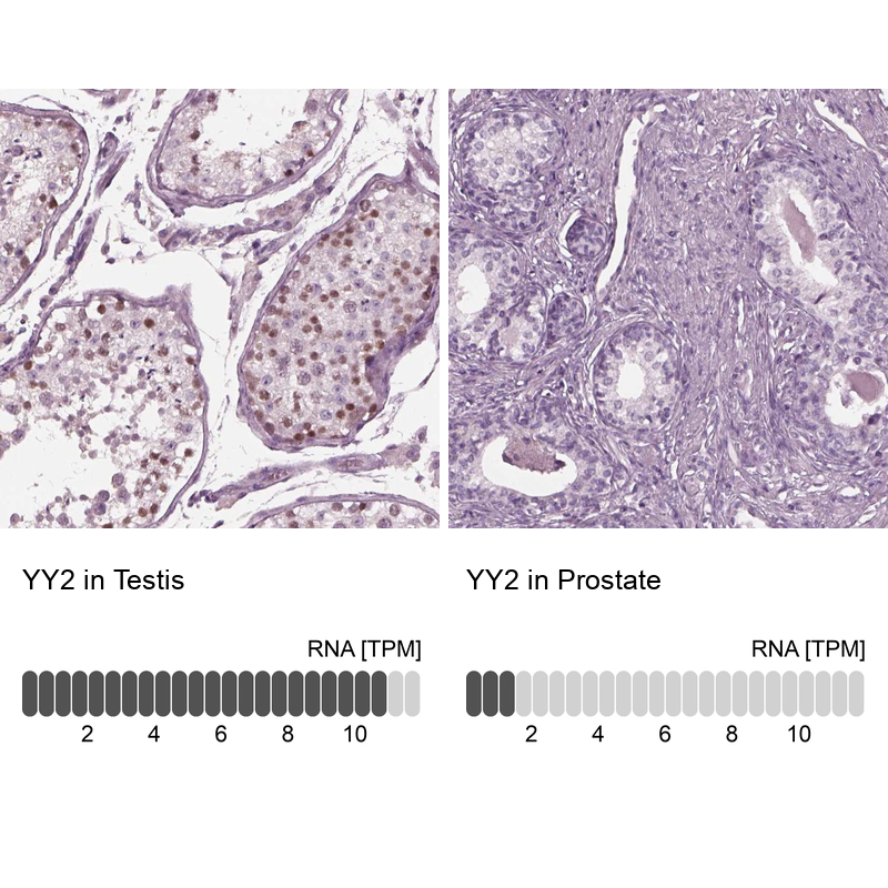 Atlas Antibodies Anti-YY2 Antibody