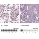 Atlas Antibodies Anti-YY2 Antibody