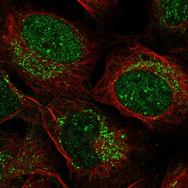Atlas Antibodies Anti-ZADH2 Antibody