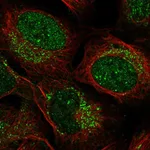 Atlas Antibodies Anti-ZADH2 Antibody