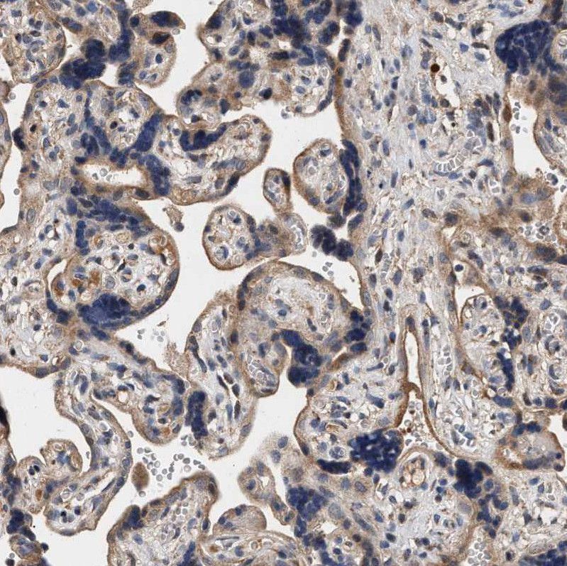 Atlas Antibodies Anti-ZADH2 Antibody