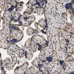 Atlas Antibodies Anti-ZADH2 Antibody