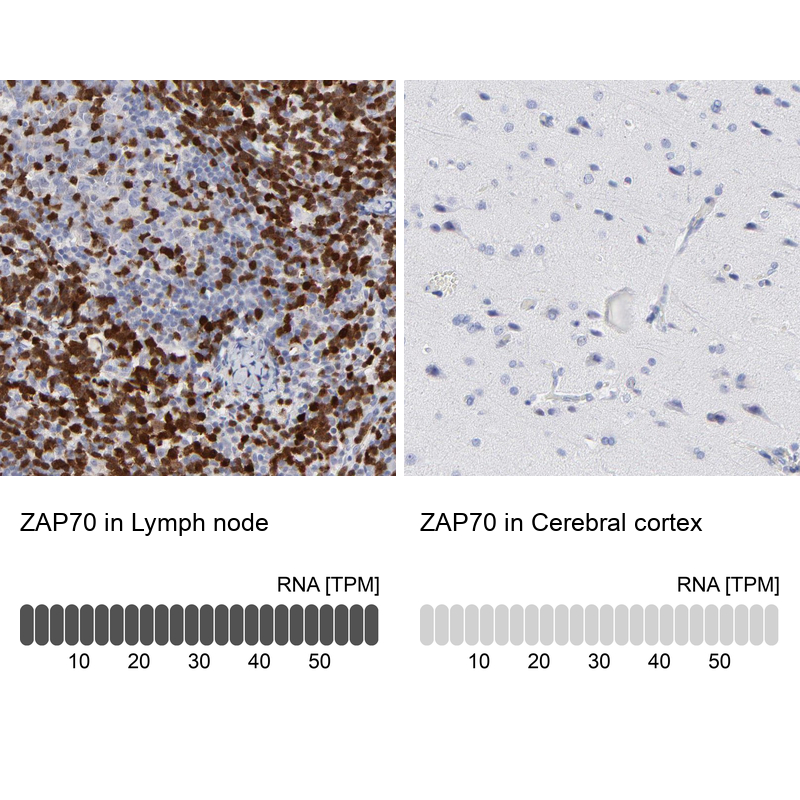 Atlas Antibodies Anti-ZAP70 Antibody