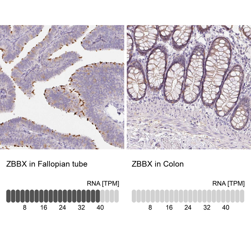 Atlas Antibodies Anti-ZBBX Antibody