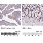 Atlas Antibodies Anti-ZBBX Antibody