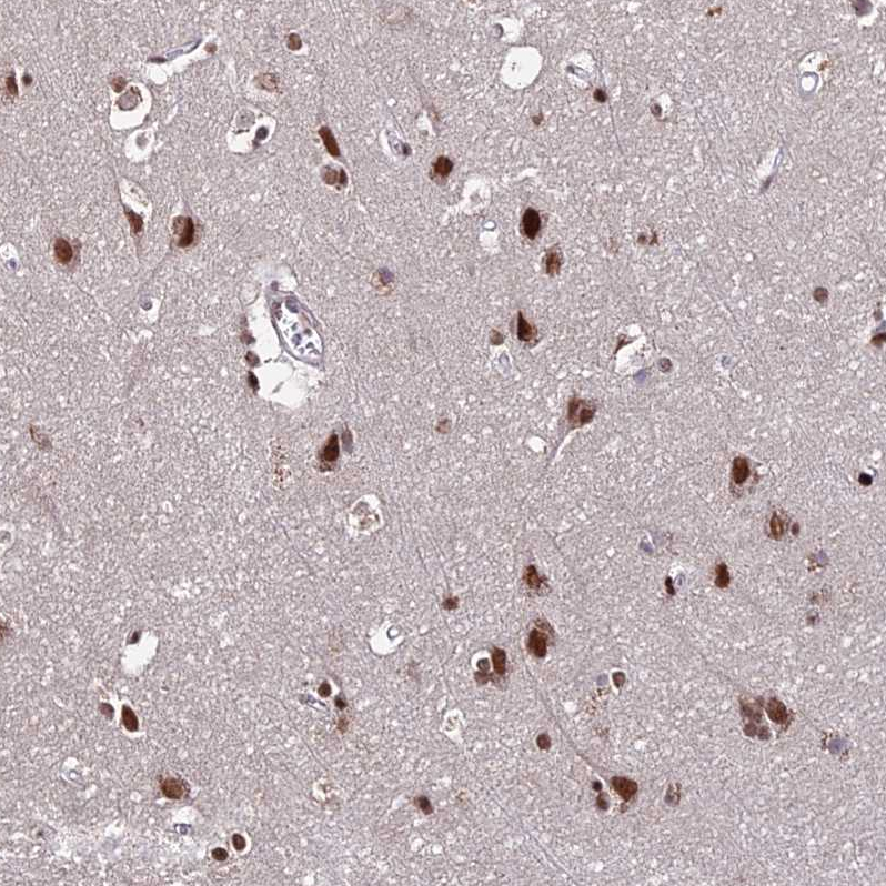 Atlas Antibodies Anti-ZBED4 Antibody