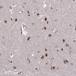 Atlas Antibodies Anti-ZBED4 Antibody