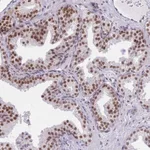 Atlas Antibodies Anti-ZBED5 Antibody