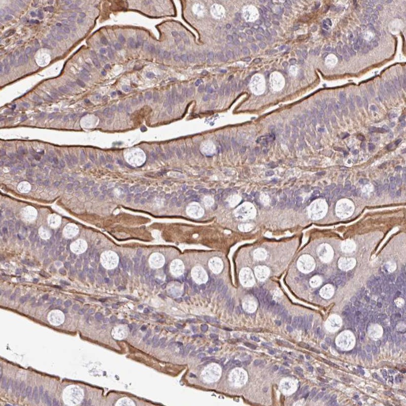 Atlas Antibodies Anti-ZBED3 Antibody
