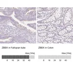 Atlas Antibodies Anti-ZBBX Antibody