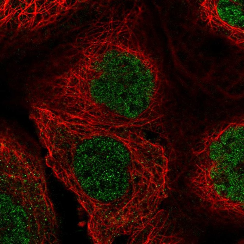 Atlas Antibodies Anti-ZBED8 Antibody