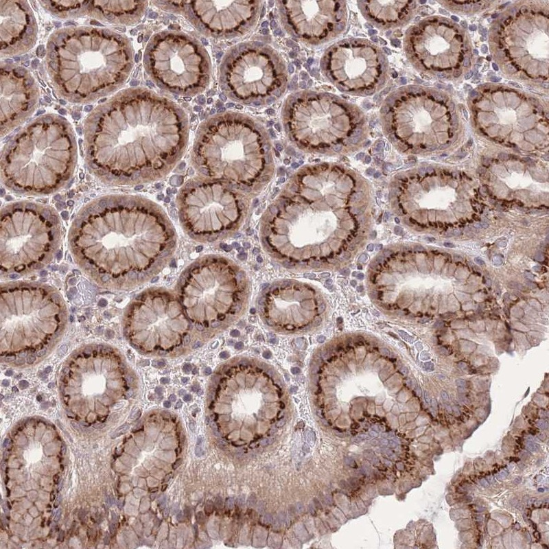 Atlas Antibodies Anti-ZBED5 Antibody