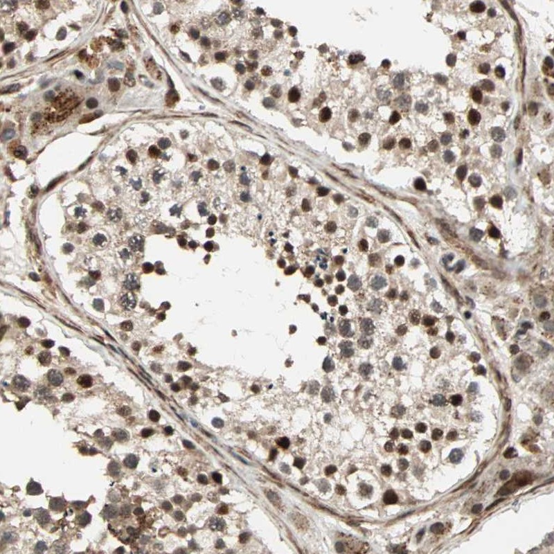 Atlas Antibodies Anti-ZBED9 Antibody